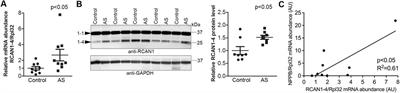 Calcineurin-NFAT dynamics correspond to cardiac remodeling during aortic banding and debanding, mimicking aortic valve replacement